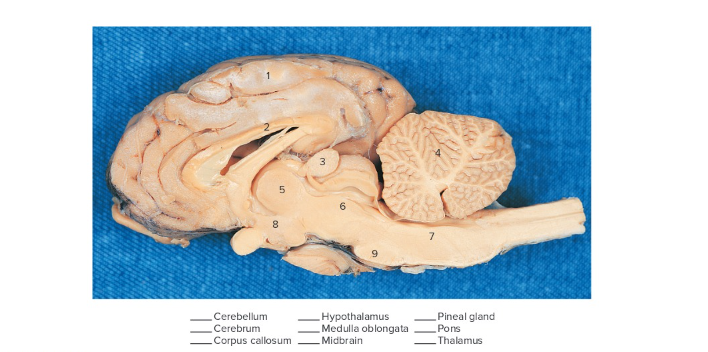 <p>Label the following:</p>