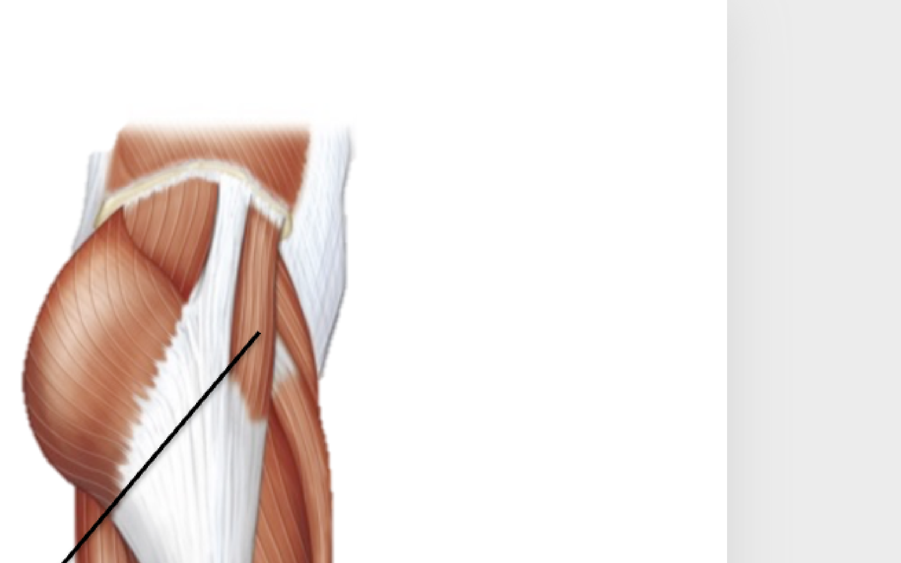 <p>What muscle is this?</p>