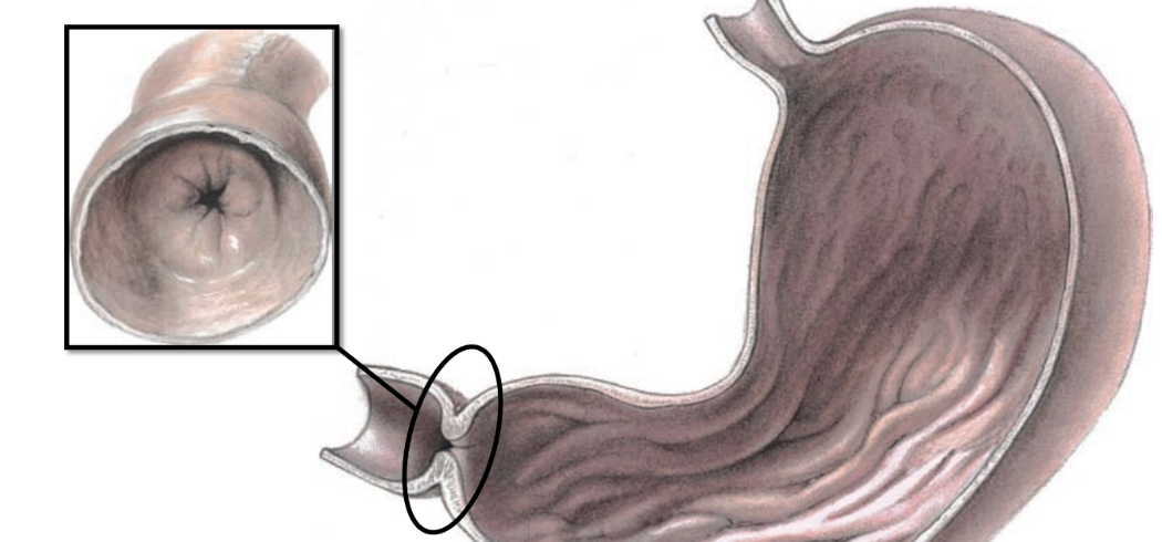 <p>relaxes to let chyme exit stomach &amp; enter small intestine</p>