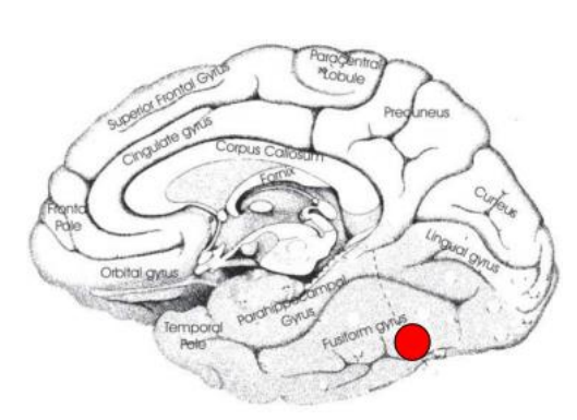 L’agnosie aperceptive