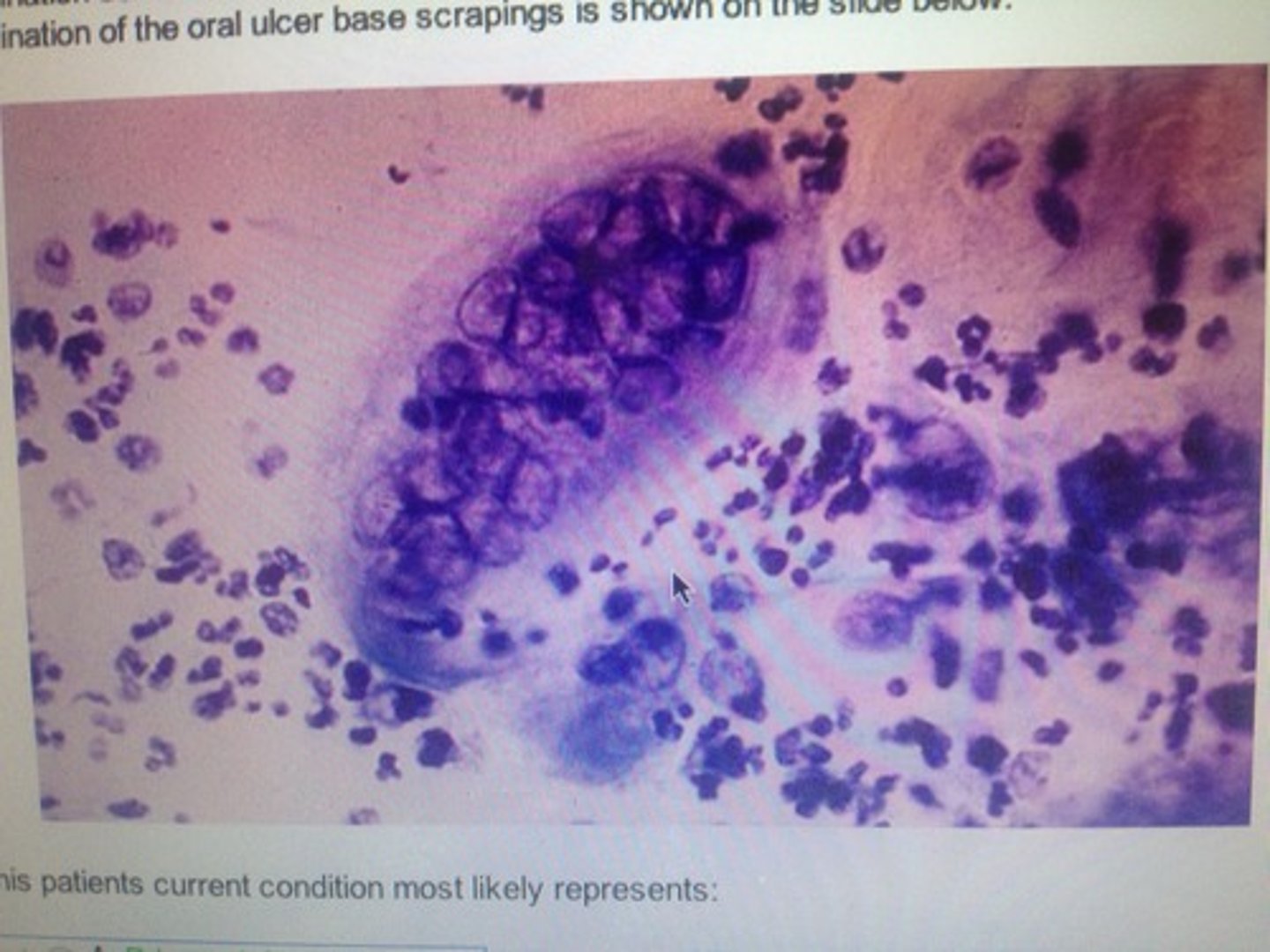<p>ID this smear</p>