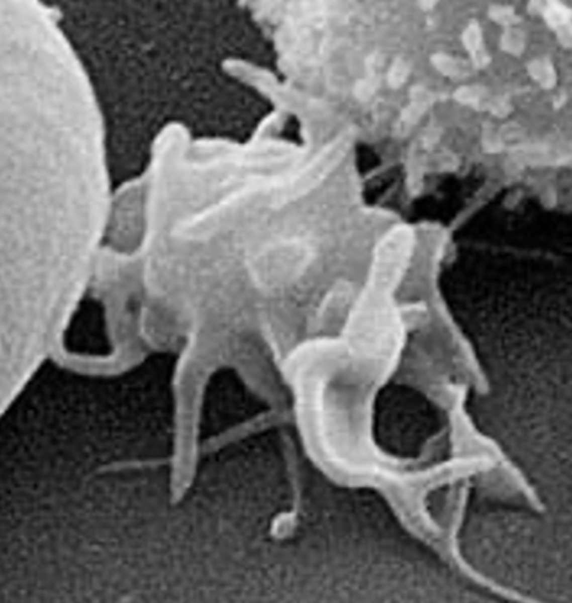 <p><br><span><span>help with blood clotting</span></span></p>