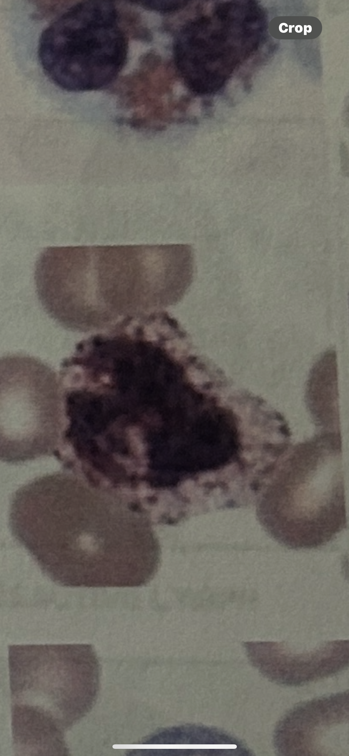<p>WBC</p>