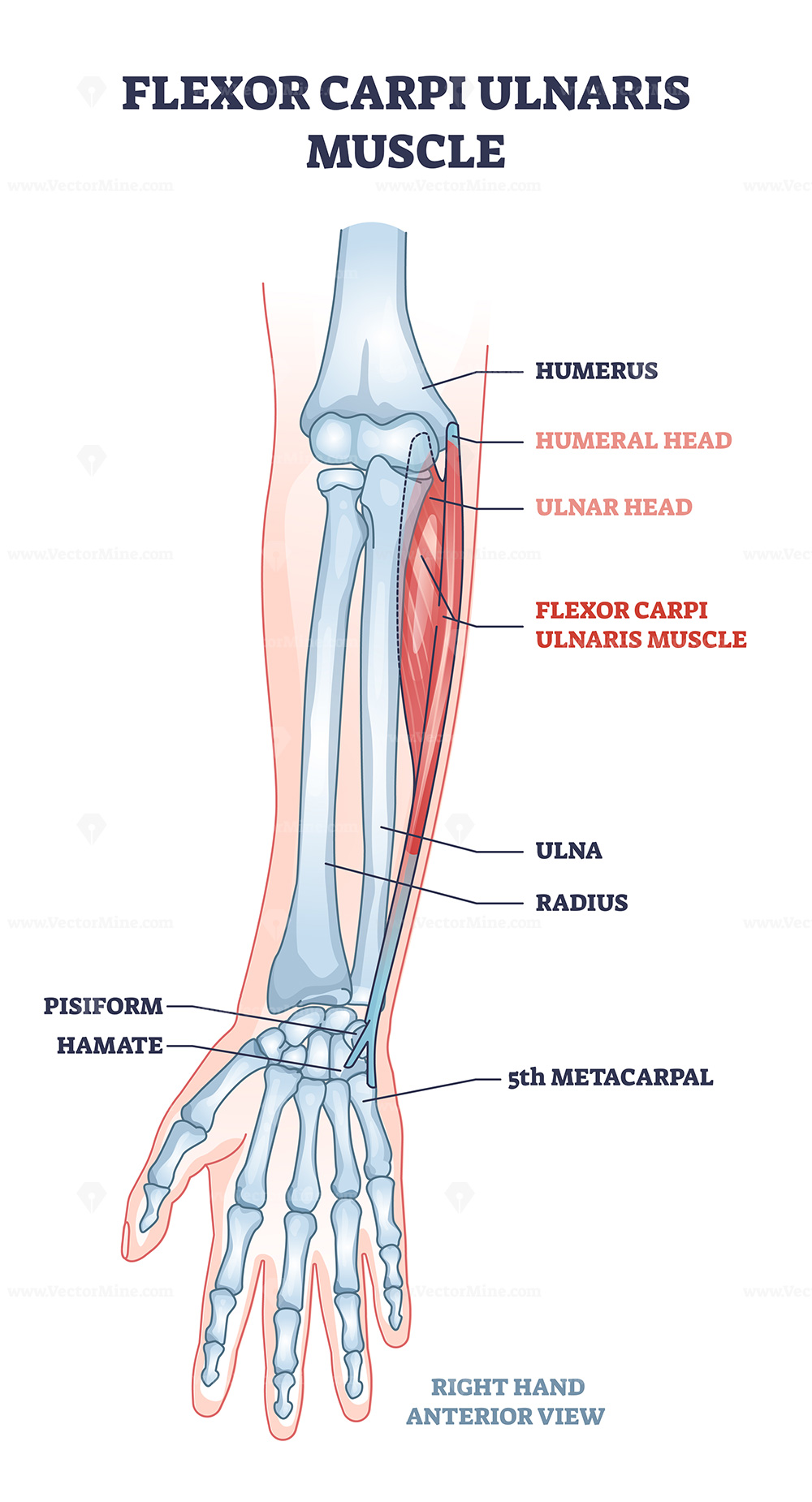 <p>Flexor carpi ulnaris</p>