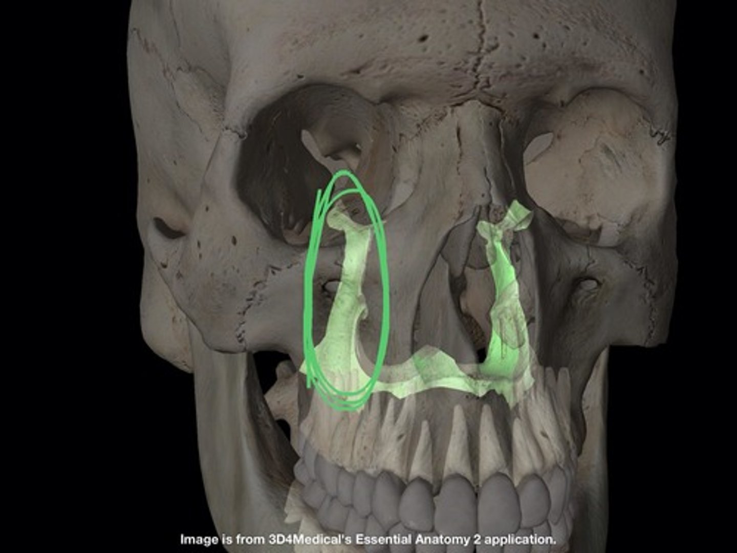<p>In lateral wall of nasal cavity, up and down, sides of "H"</p>