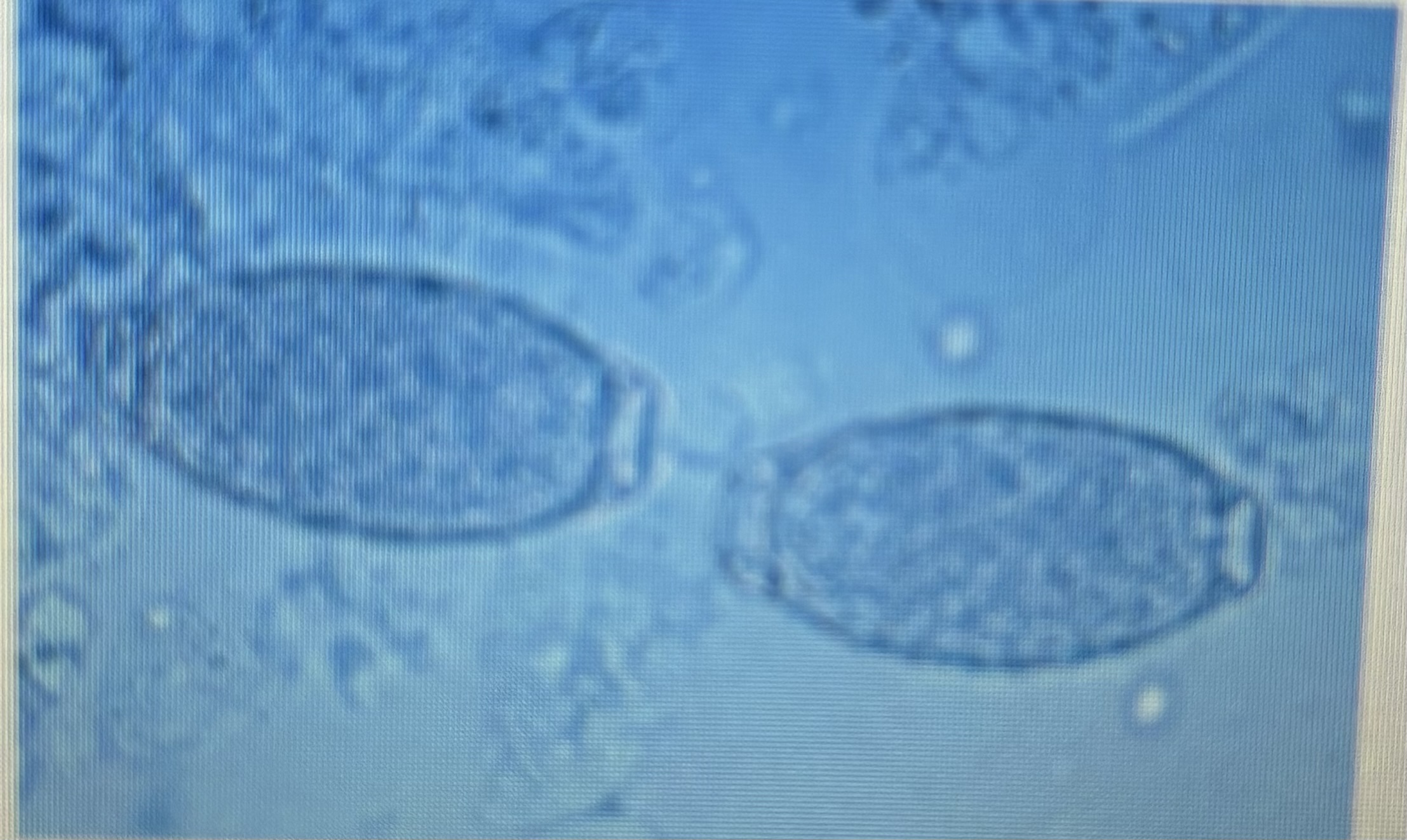 <p>Urinary parasites </p><p>Indirect life cycle </p>