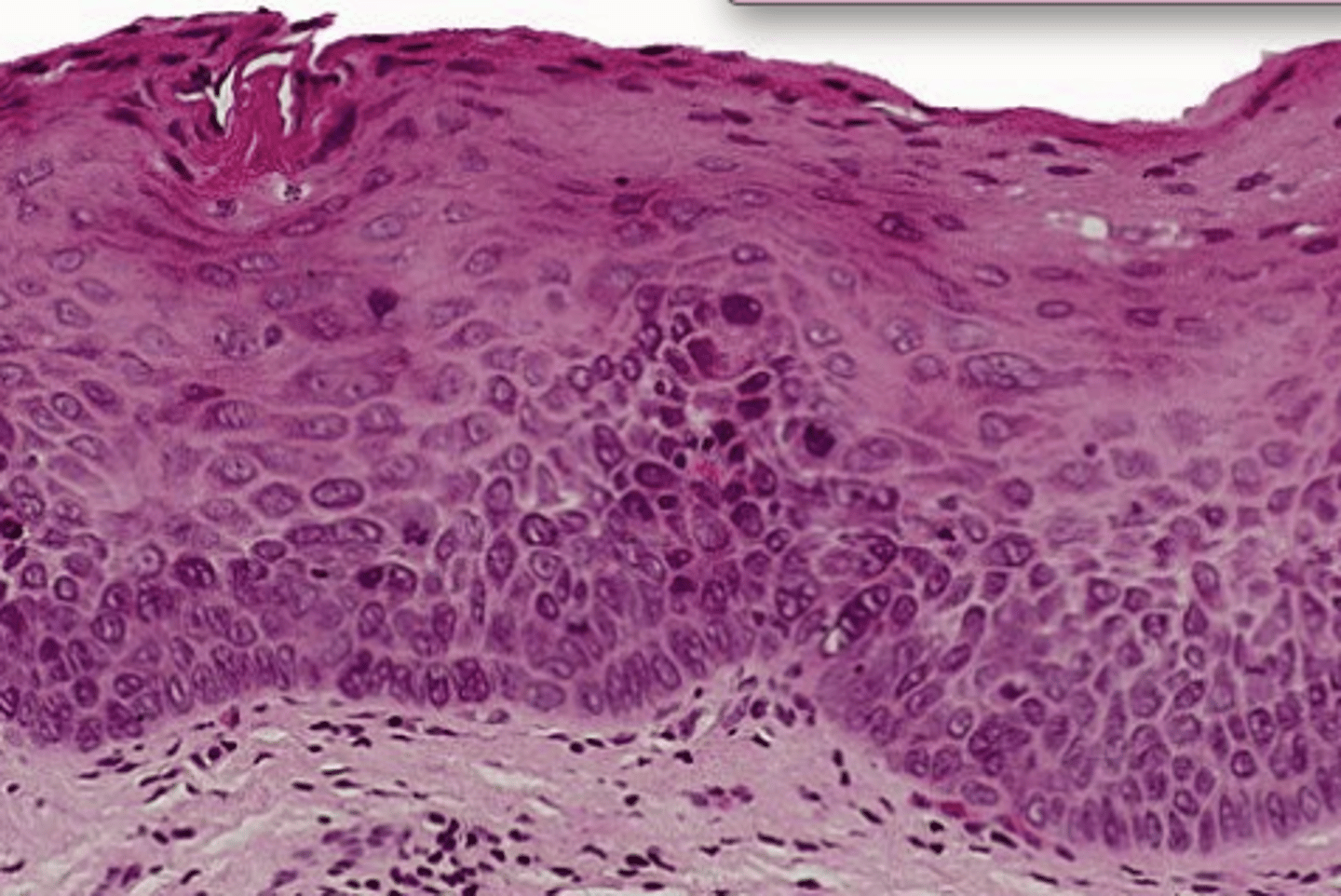 <p>Lower 1/2 of the epithelium</p>
