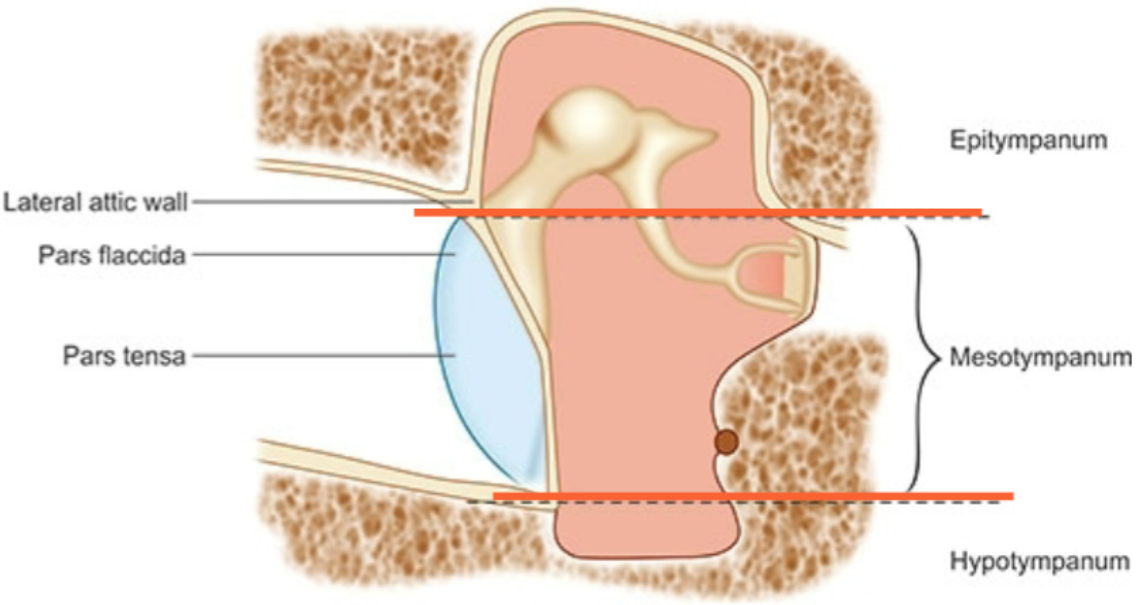 <p>= lucht gevulde holte bekleed met dun laag slijmvlies</p><p>3 delen:&nbsp;</p><ol><li><p>epitympanum</p></li><li><p>mesotympanum</p></li><li><p>hypotympanum</p></li></ol><p></p>