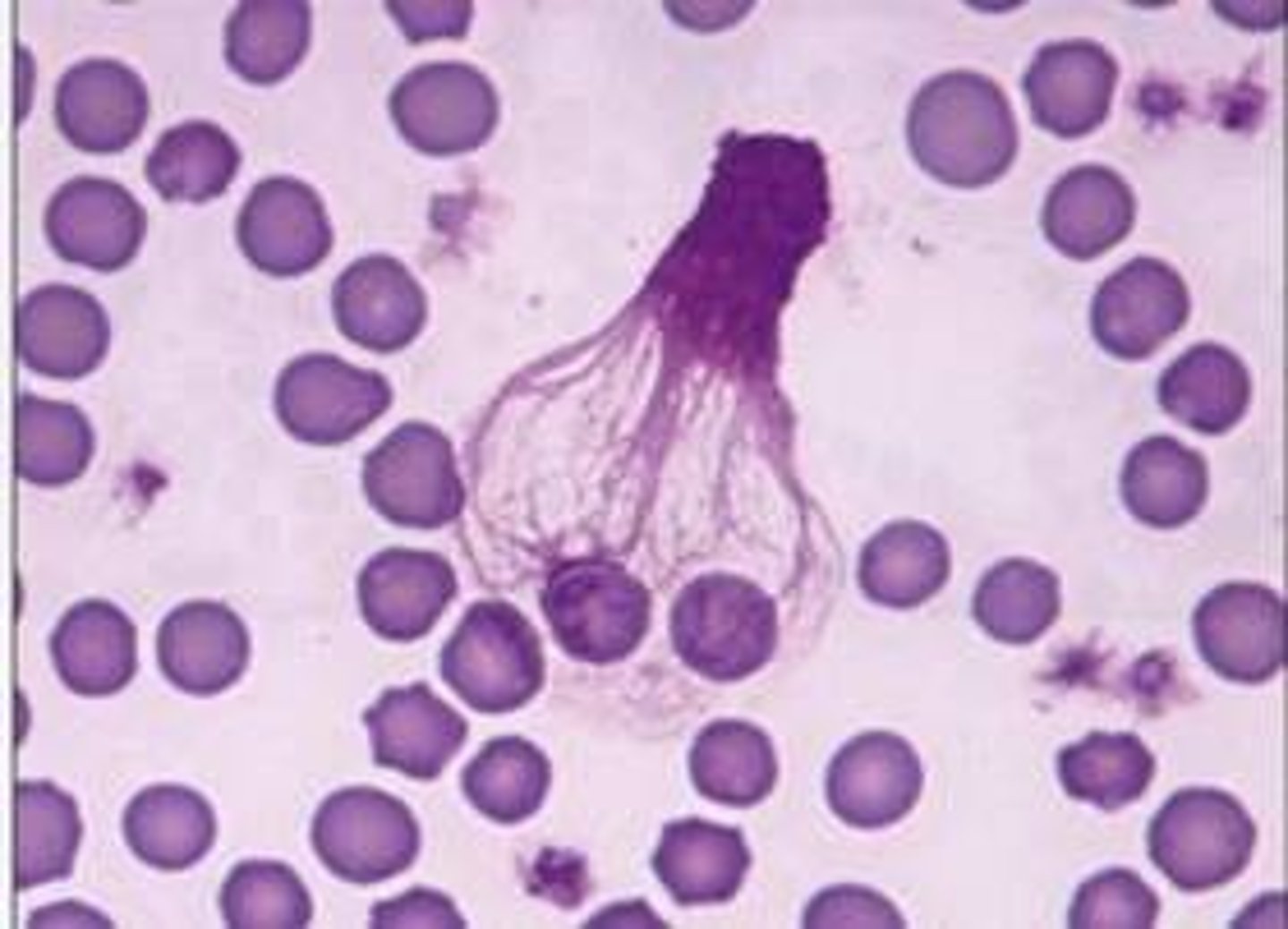 <p>WBCs that were ruptured during smear preparation and their nuclear chromatin may spread out and form an amorphous, netlike structure are often called __________________ cells</p>