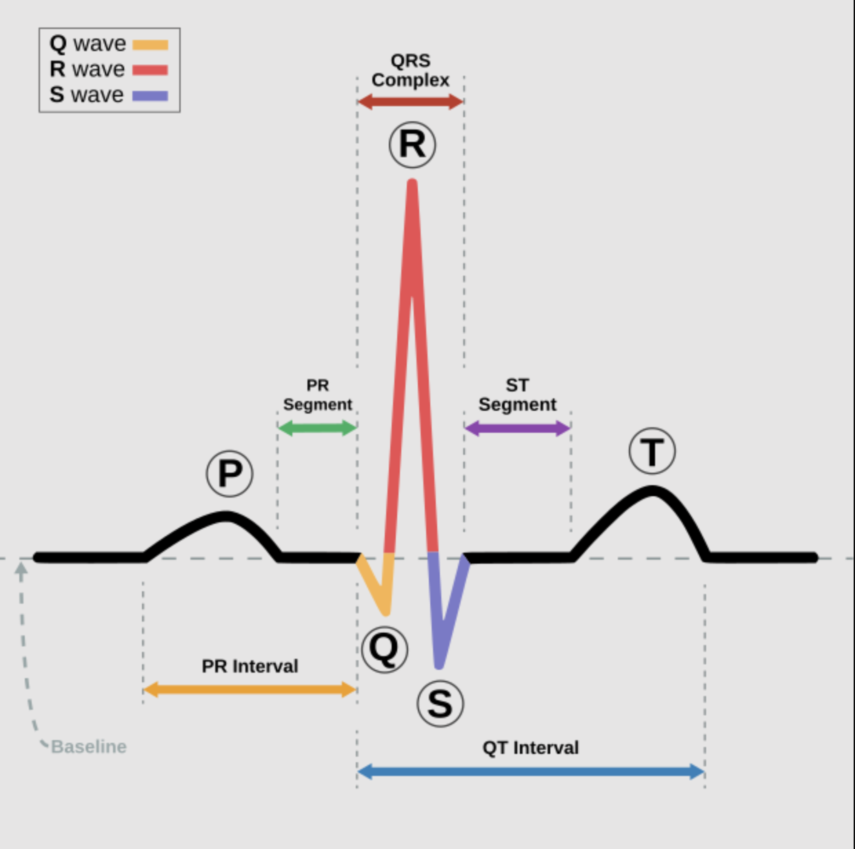 <p>QRS</p>