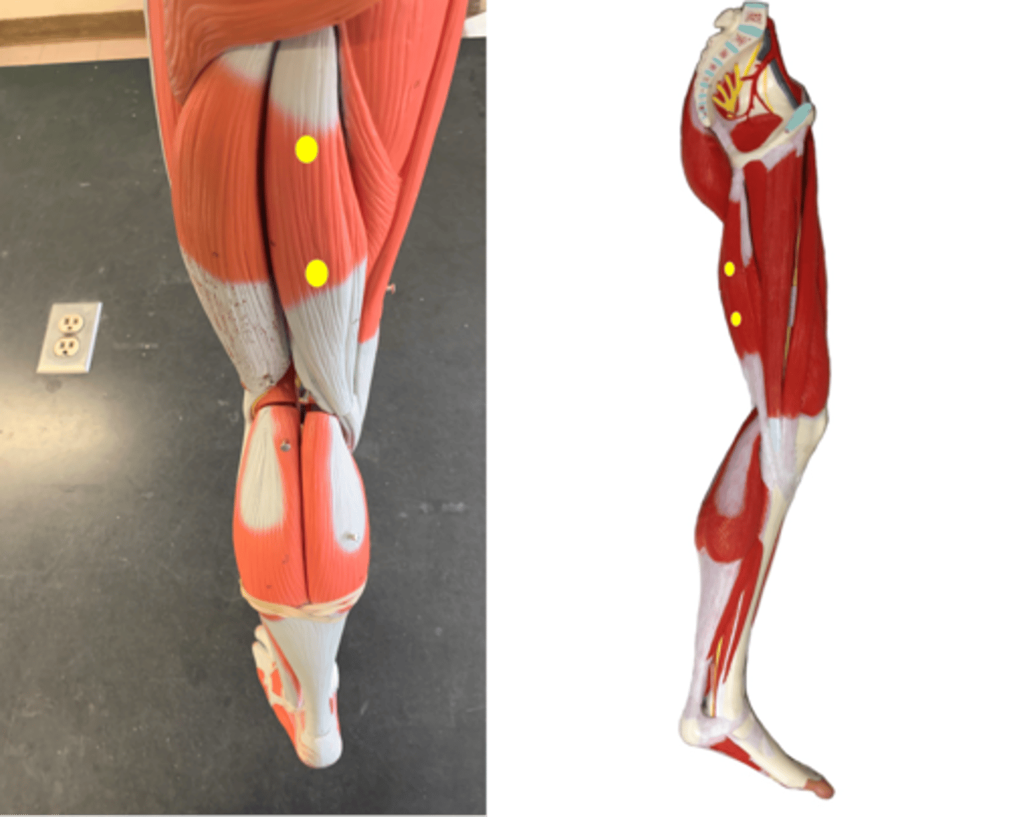 <p>Medial side</p>