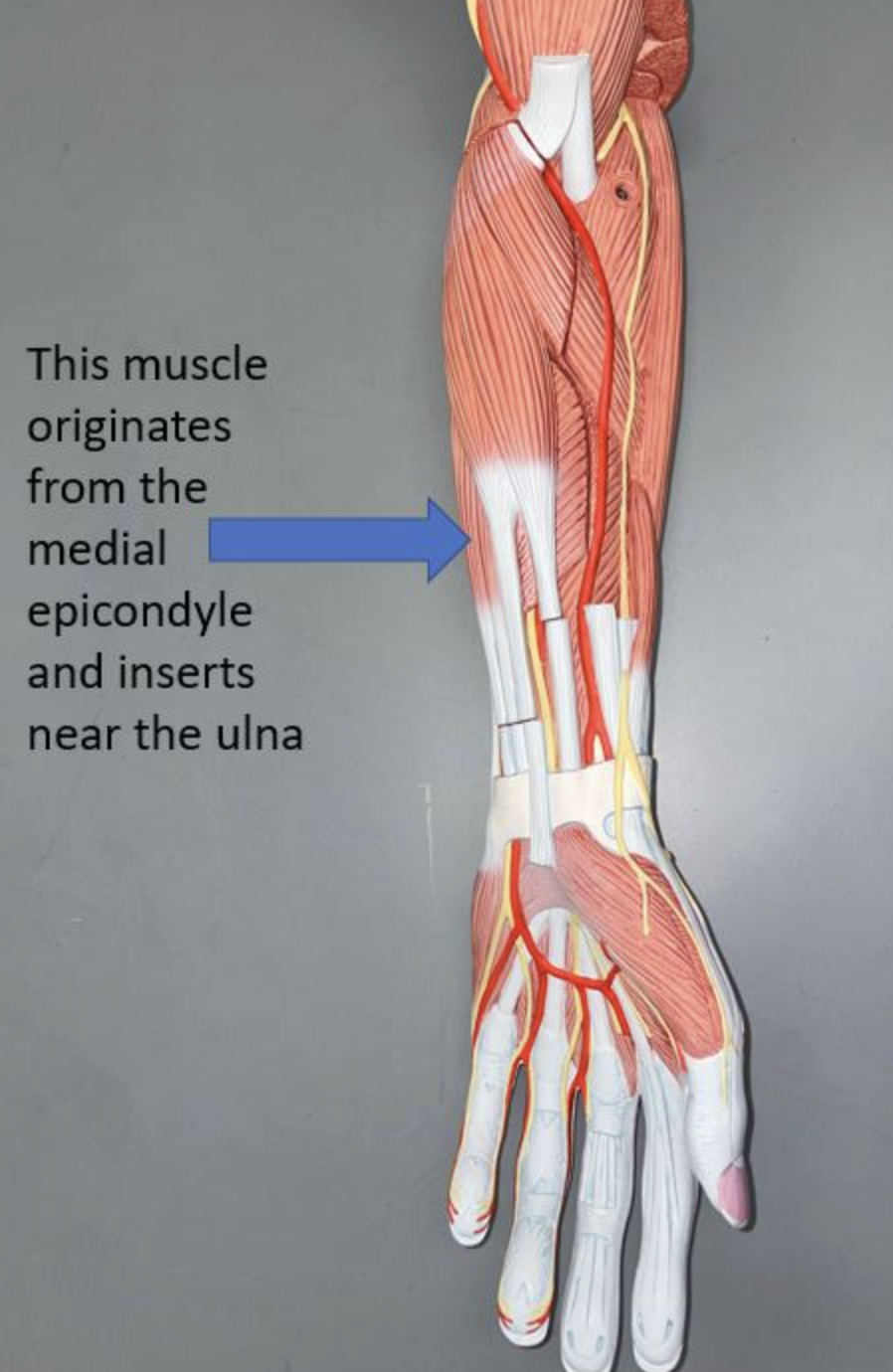 <p>muscle name & function</p>