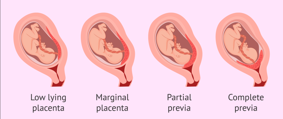 <p>Marginal</p>