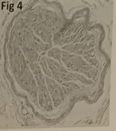 <p>Identify the name of the structure in figure :</p><p>A. Nerve ganglion</p><p>B. Peripheral nerve, transversal cut</p><p>C. Cerebellum</p><p>D. Serous acini in salivary gland.</p>