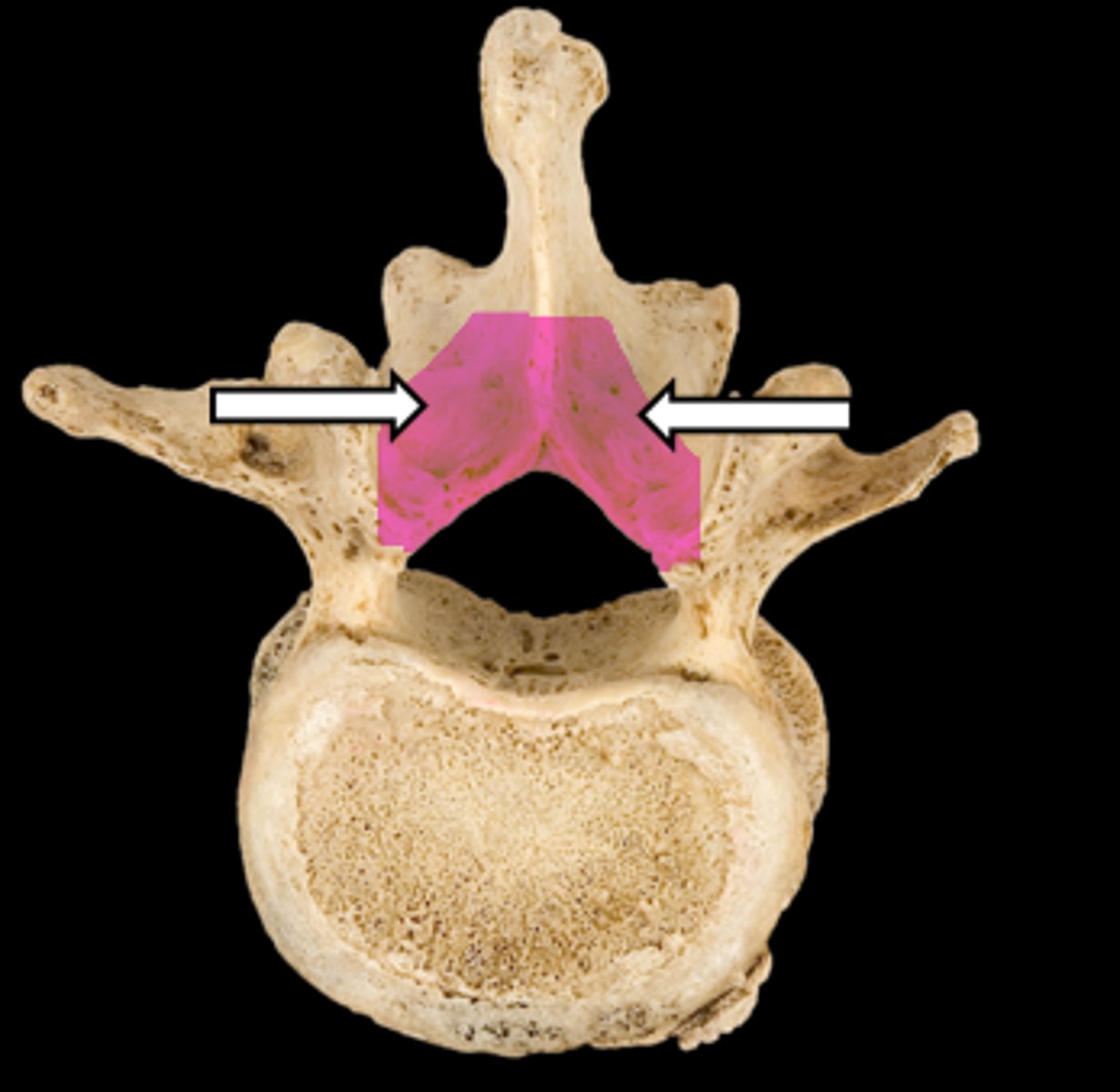 <p>name the part</p>