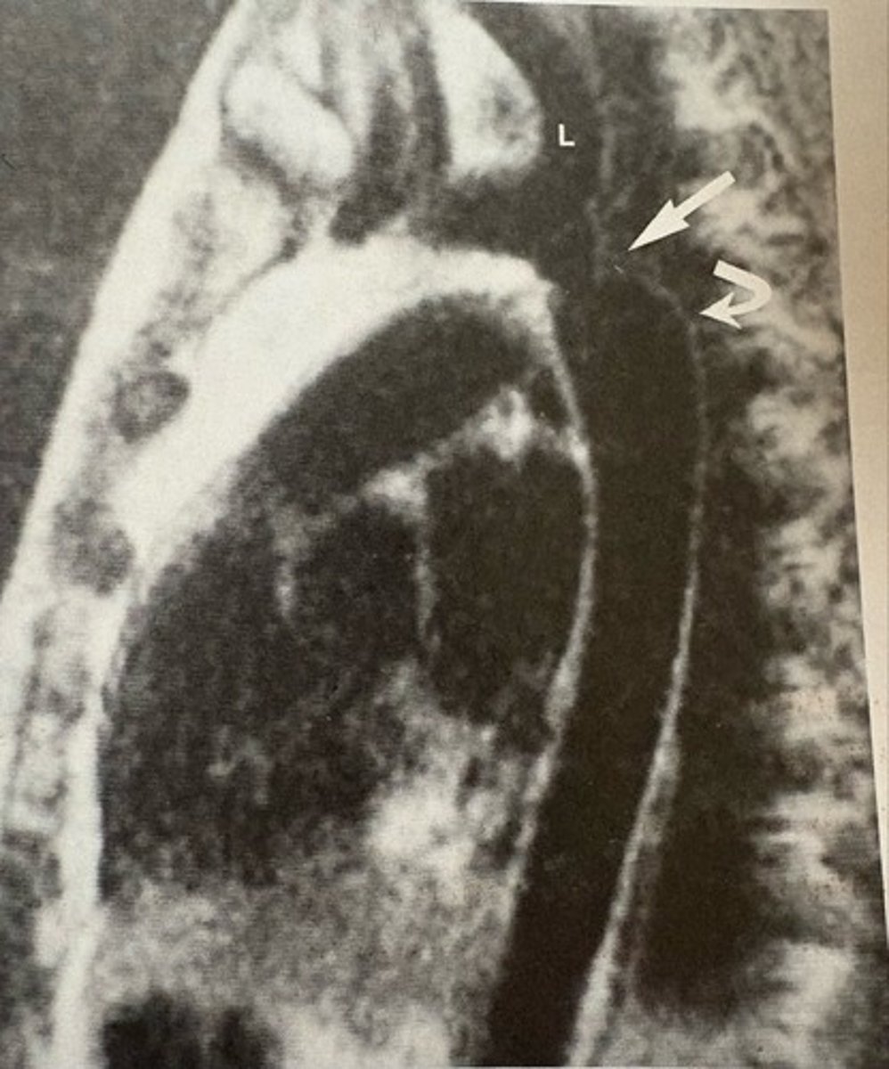 <p>what pathology is present?</p>