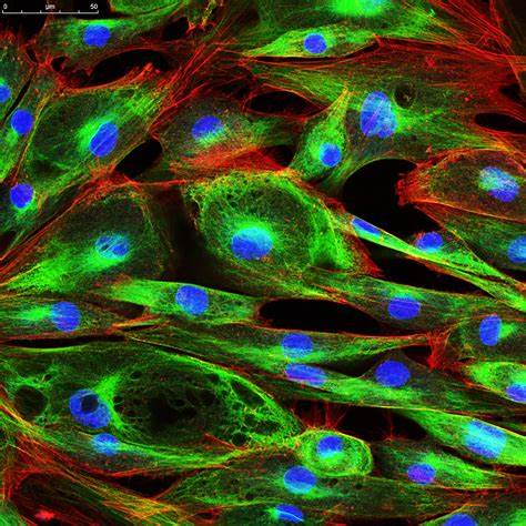 Confocal microscopy in fibroblasts cells