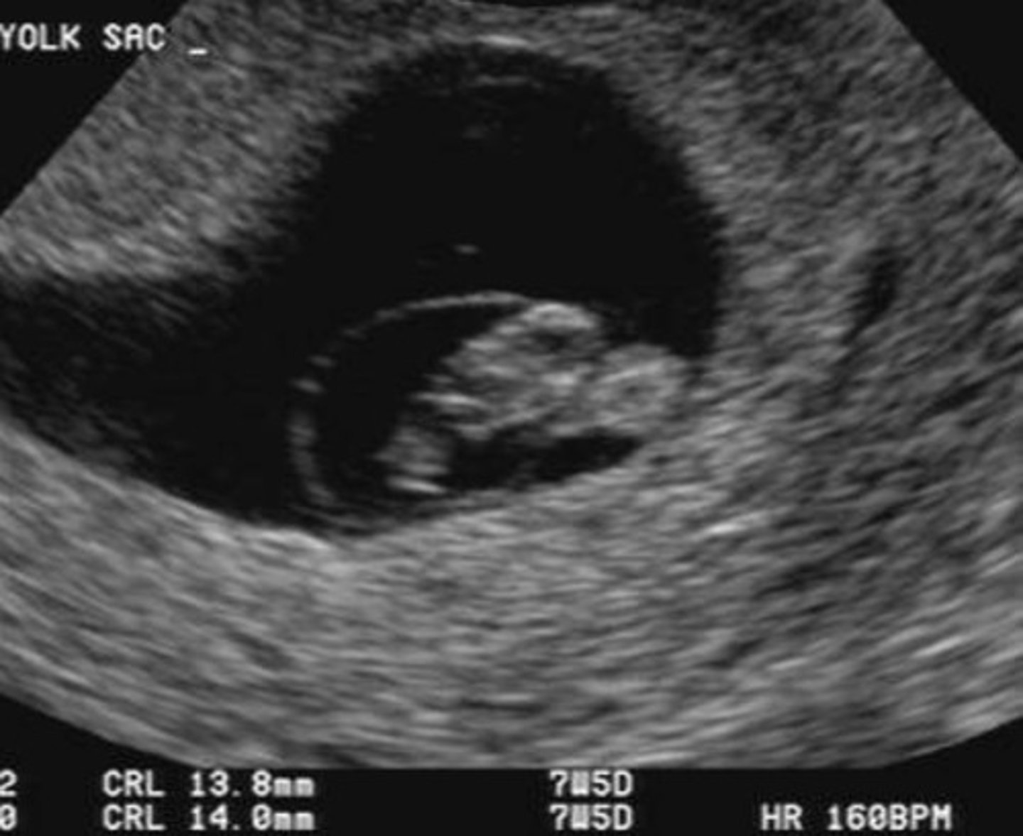<p>C-shaped embryo</p><p>Ear + eye development</p><p>Tail going away</p><p>Bulging heart</p><p>Single vesicle in brain</p>