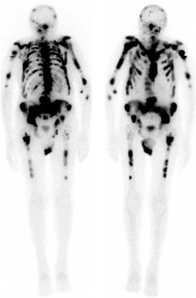 <p>Superscan </p>