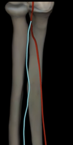 <p>What is highlighted in blue?</p>