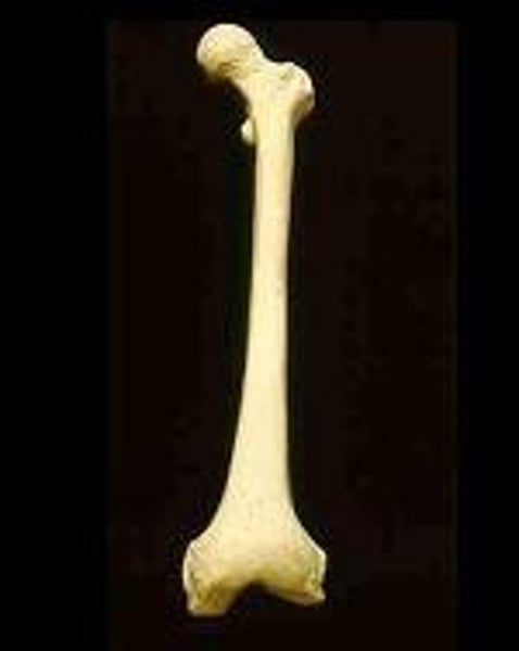 <p>bone</p>