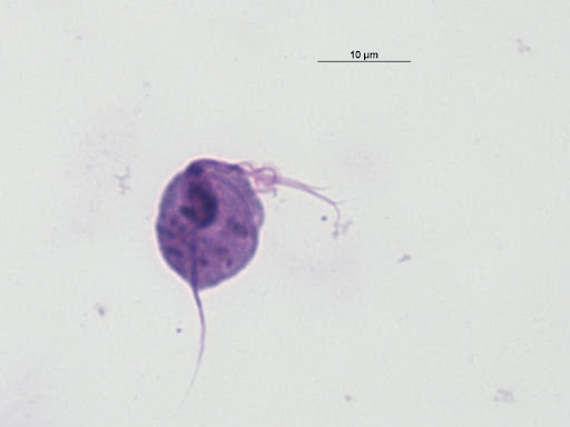 <p><strong>Phylum Parabasilida</strong></p>
