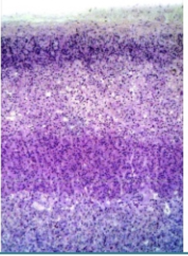 <p>Adrenal Cortex</p>