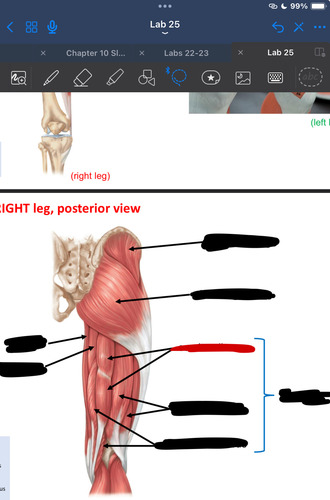 <p>What muscle is this?</p>