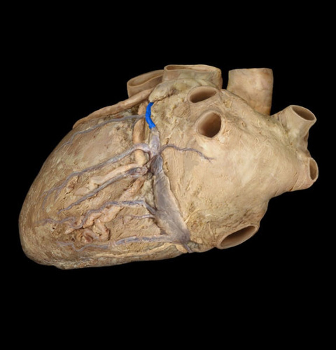 <p>begins in the anterior interventricular sulcus</p><p>left side of the 'T'</p>