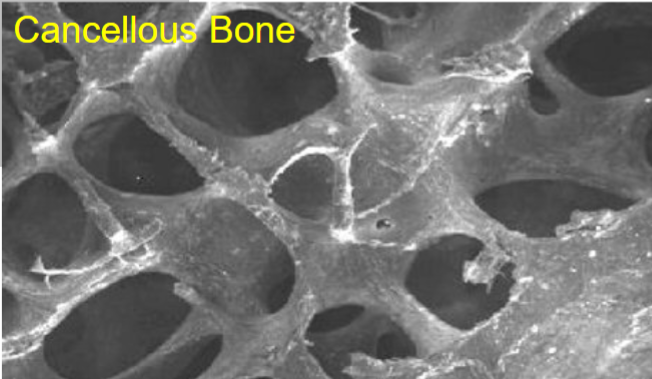 <p><u>Trabecular bone</u> found in the center and ends of long bones and flat bones, made of lamellar bone</p>