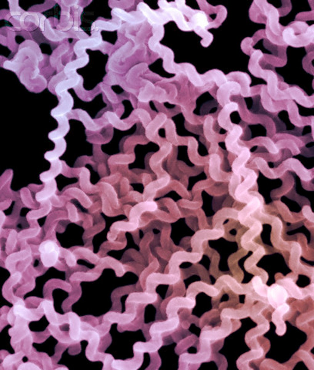 <p>Spiral shaped</p>