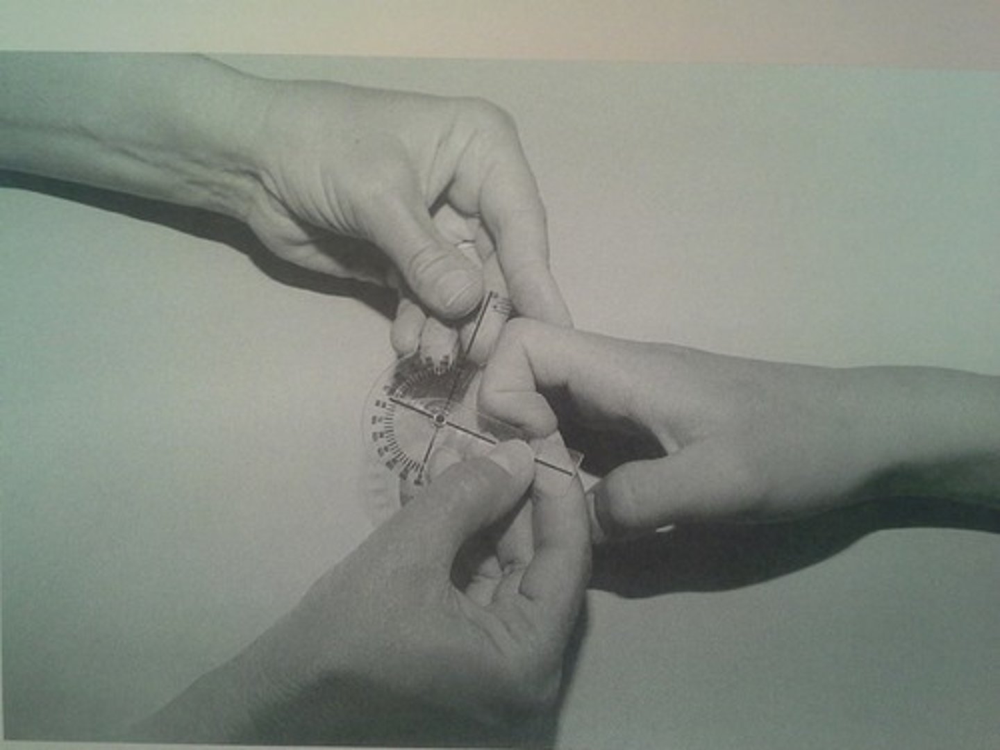 <p>fulcrum: dorsal DIP joint<br>proximal: dorsal midline of middle phalanx<br>distal: dorsal midline of distal phalanx<br><br>* hand resting on table with medial/ulnar side on table<br>* proximal phalanx in line with MC (straight)<br>* normal value = 90</p>