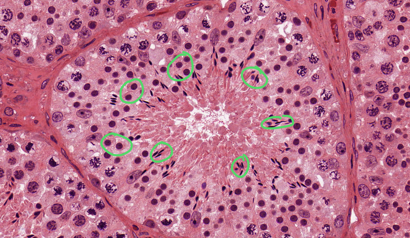 <p>histo in general;</p>