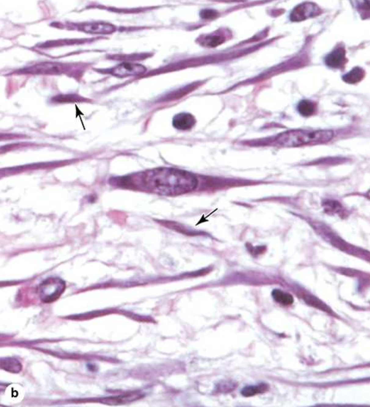 <p>Fibroblasts are highly active with high metabolic activity while fibrocytes are relatively inactive and “mature”.</p>