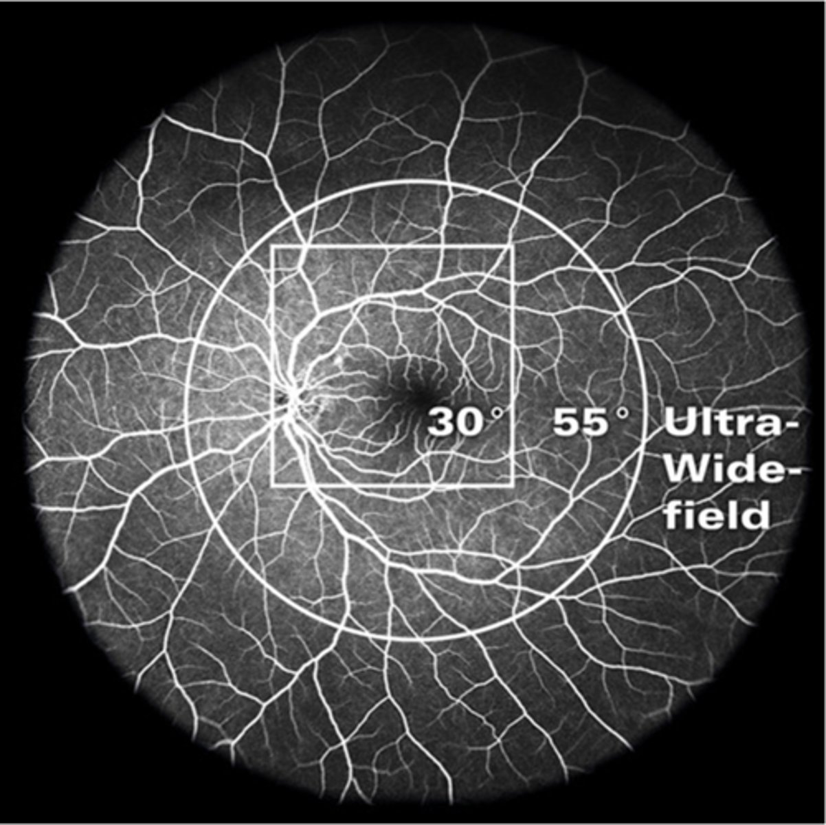 <p>different lens attachments</p>