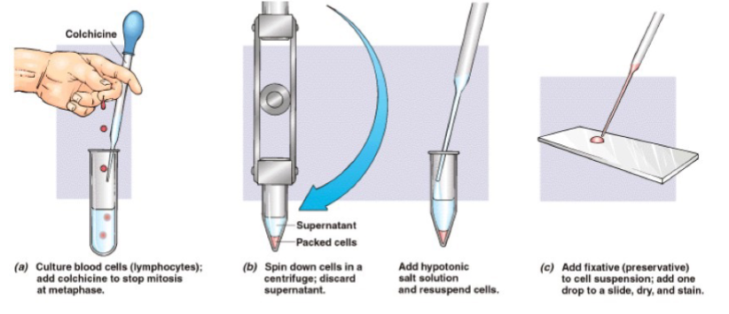 <p>Treat with colchicine which arrests the cells in metaphase</p><p>Stain to observe the chromosomes – Giemsa Stains</p><p>Photograph or visualize using a computer</p><p>Analysis of Chromosomes (Size, position of the centromere, banding and staining regions)</p>