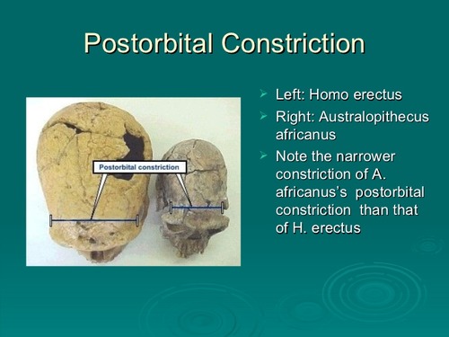 <p>post orbital constriction</p>