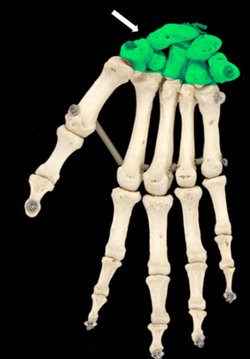 <p>name the bone</p>