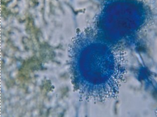 <p>olive-lime-yellow</p><p>globose vesicle w/ phialides around entire circumference</p><p>both UNI- &amp; BISERIATE</p>
