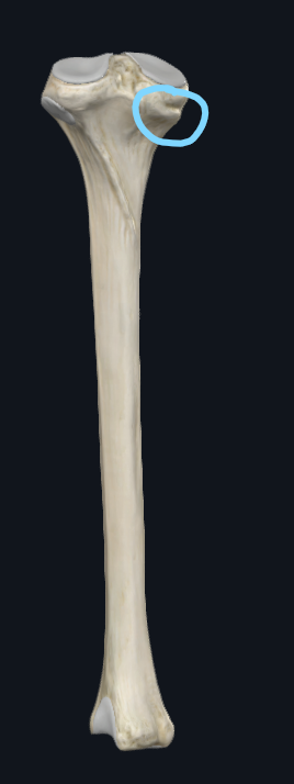 <p>What part of the tibia is this</p>