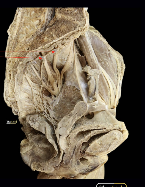 <p>ID Structure</p>