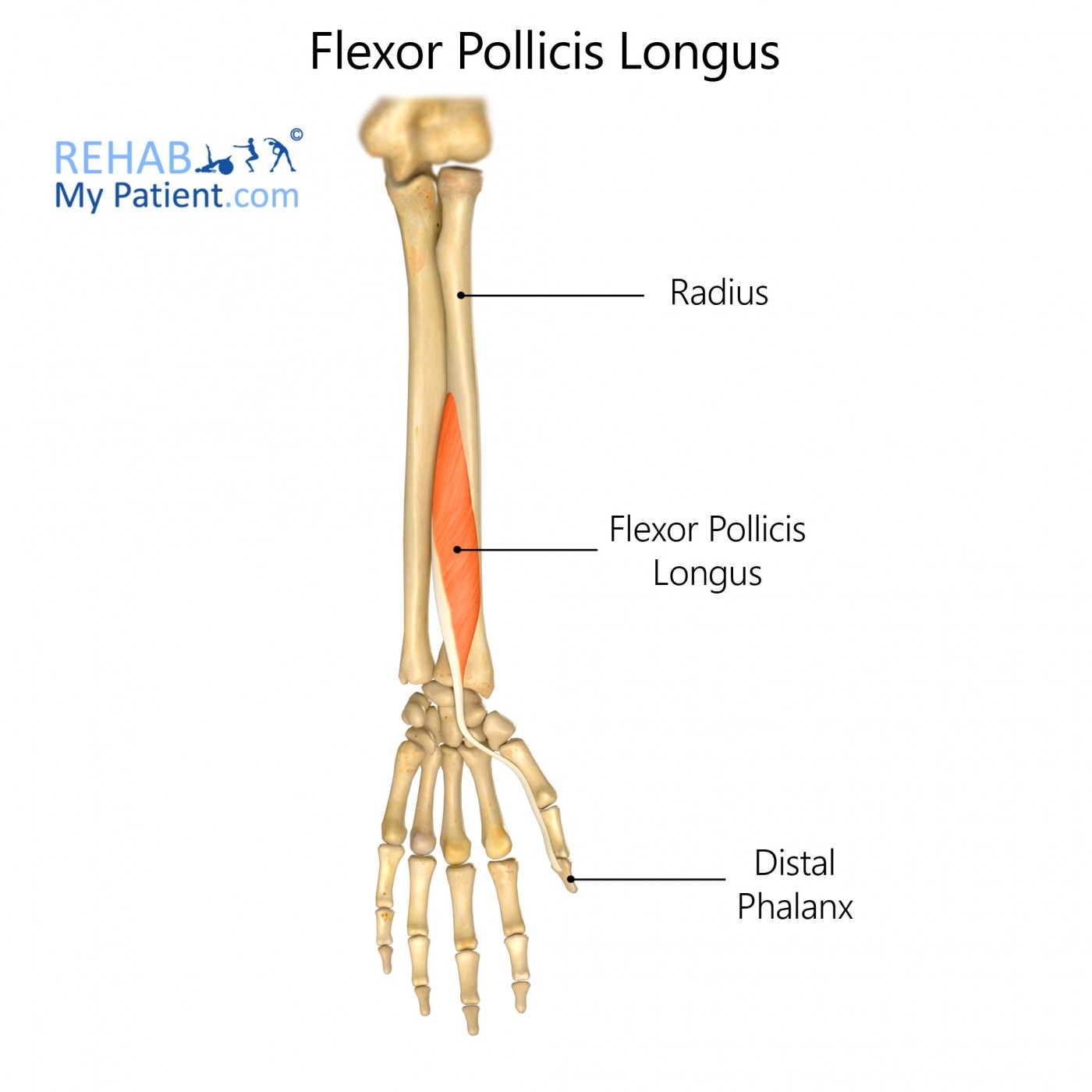 <p>Flexes distal phalanx of thumb; located in forearm extending to thumb.</p>