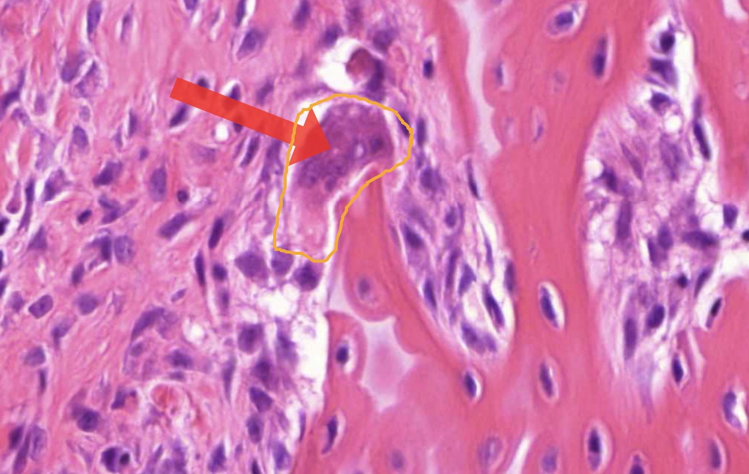 term image