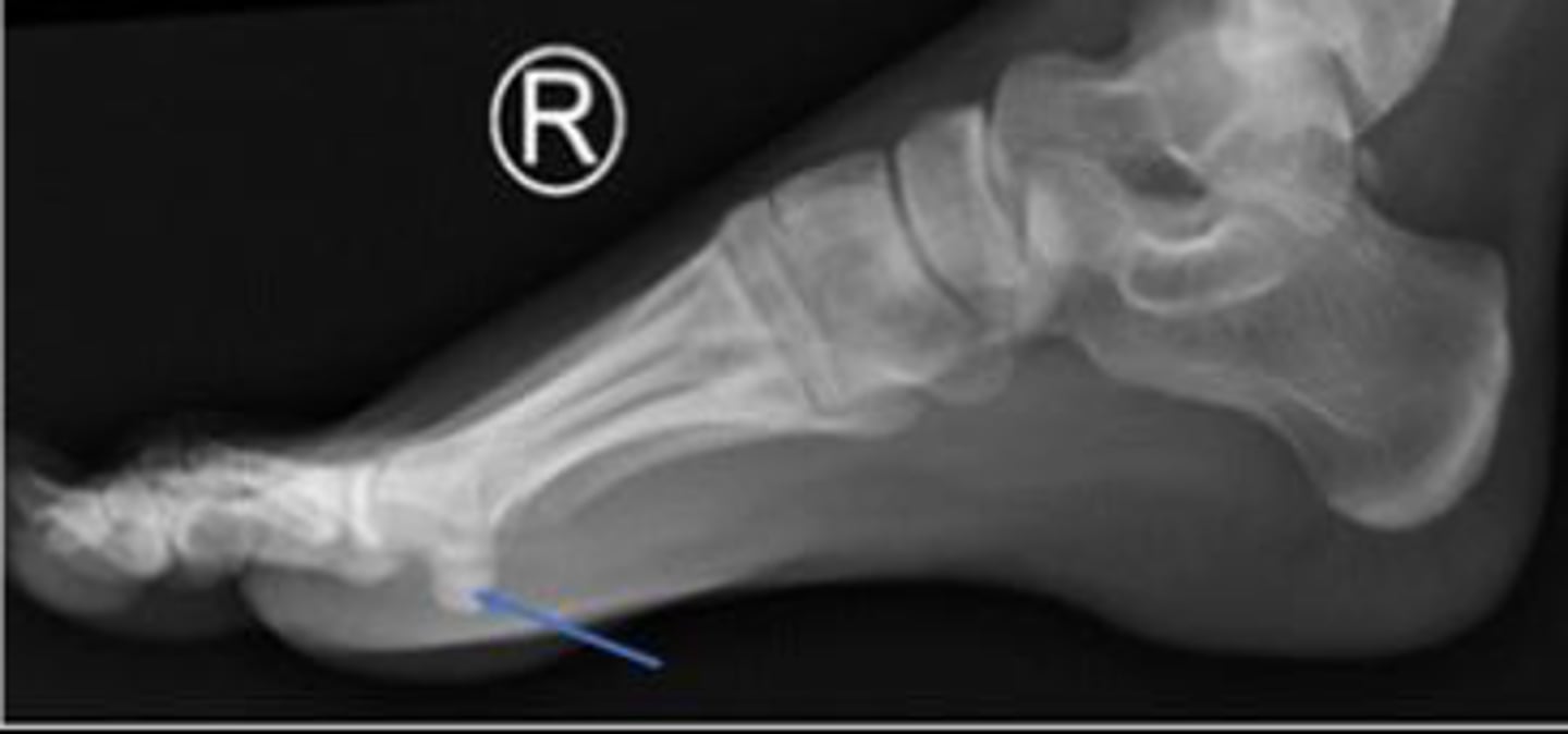 <p>What are the arrows pointing to?</p>