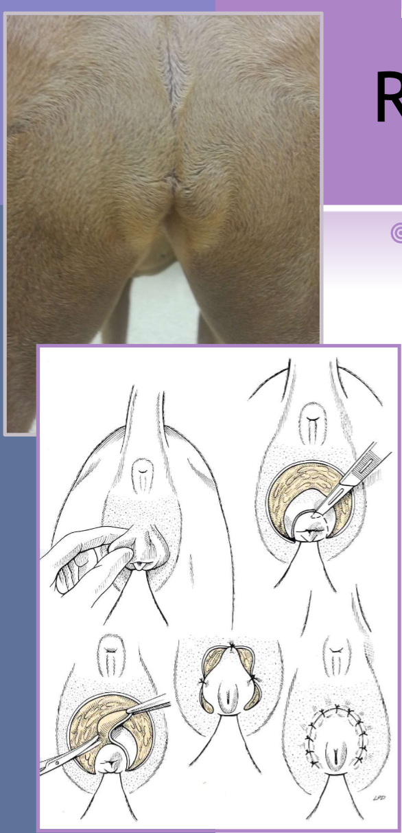 <p>vulvar fold redundant skin </p>