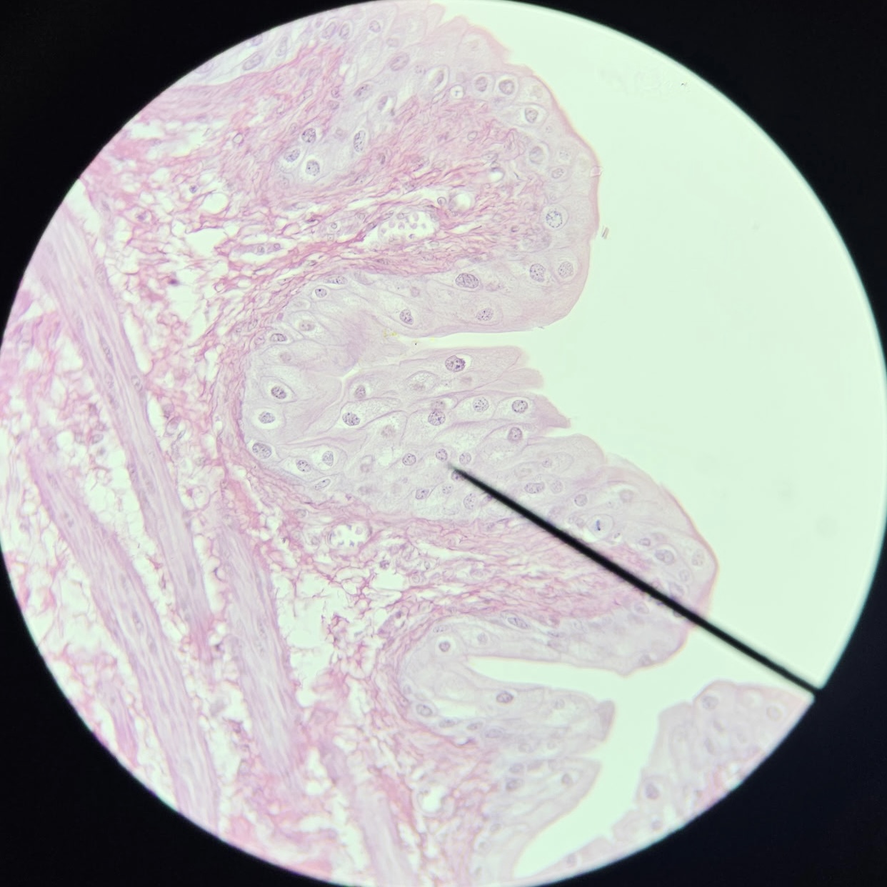 <p>Transitional Epithelium</p>