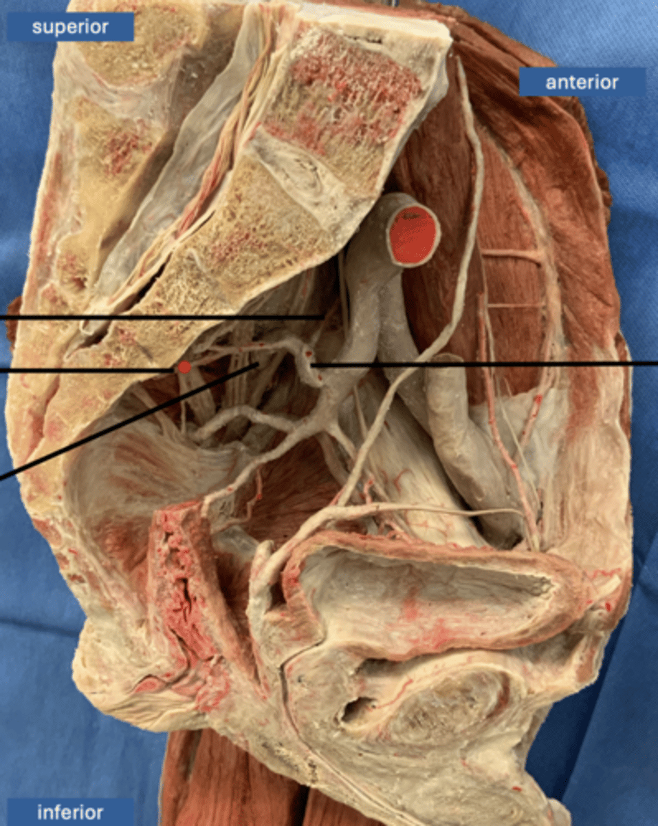 <p>artery</p>