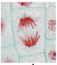 What stage of mitosis 