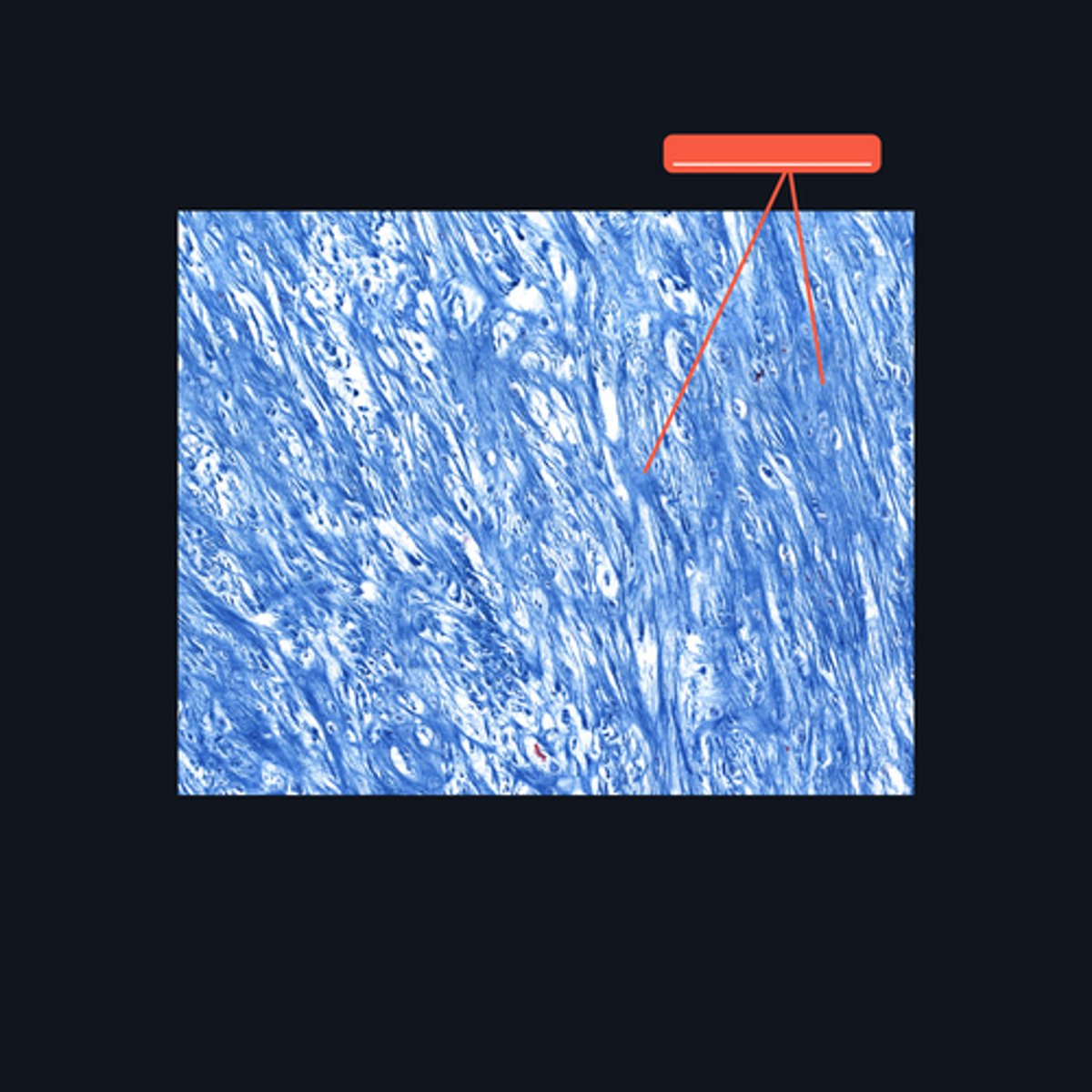 <p>This type of cartilage is abundant in what fibers?</p>