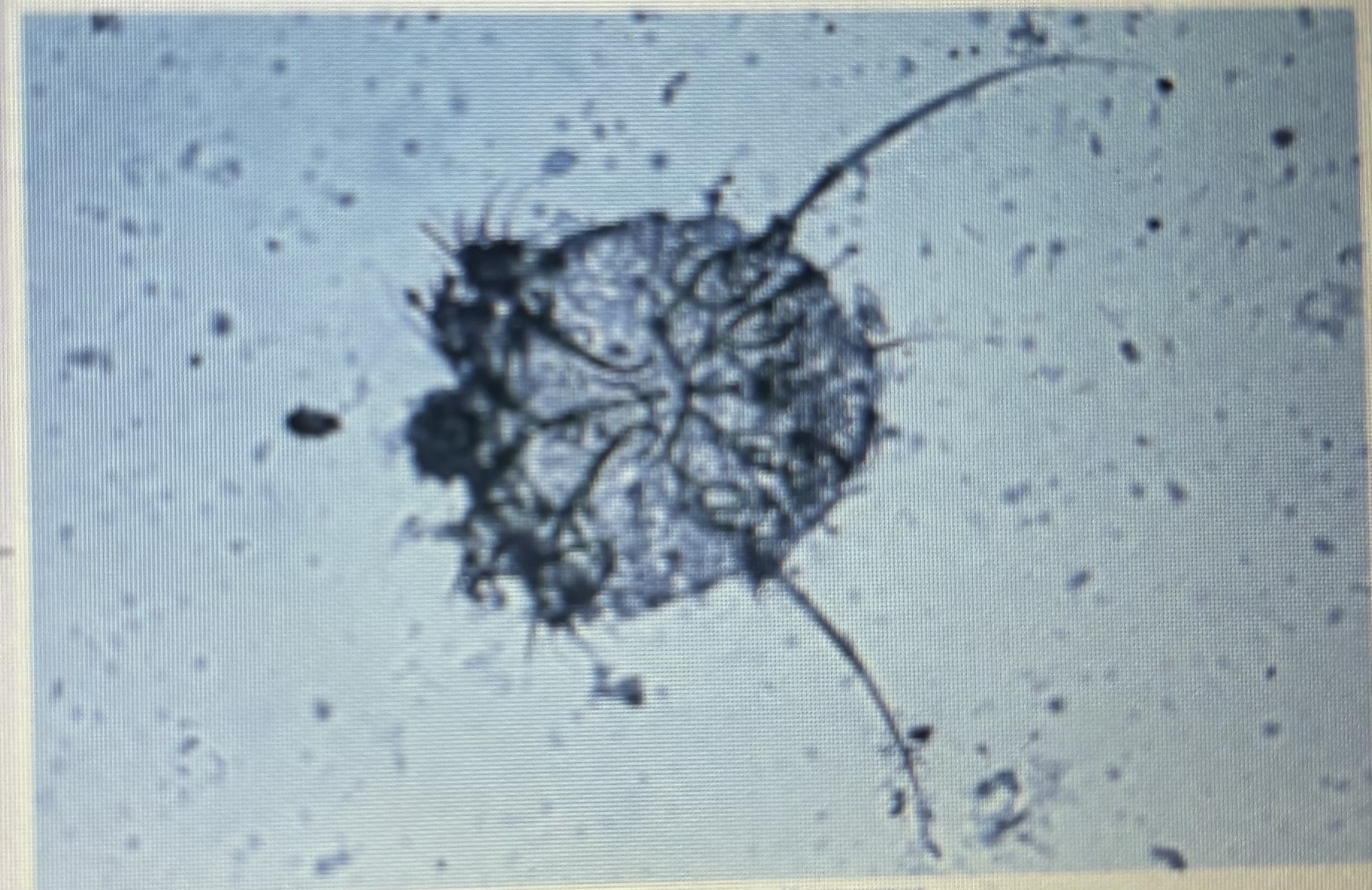 <p>Host specific</p><p>Highly contagious</p><p>Scabies</p>